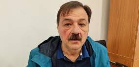 Βόλος / Μασκοφόρος ξυλοκόπησε δημοτικό σύμβουλο – Το σοκ όταν του έβγαλαν τη μάσκα