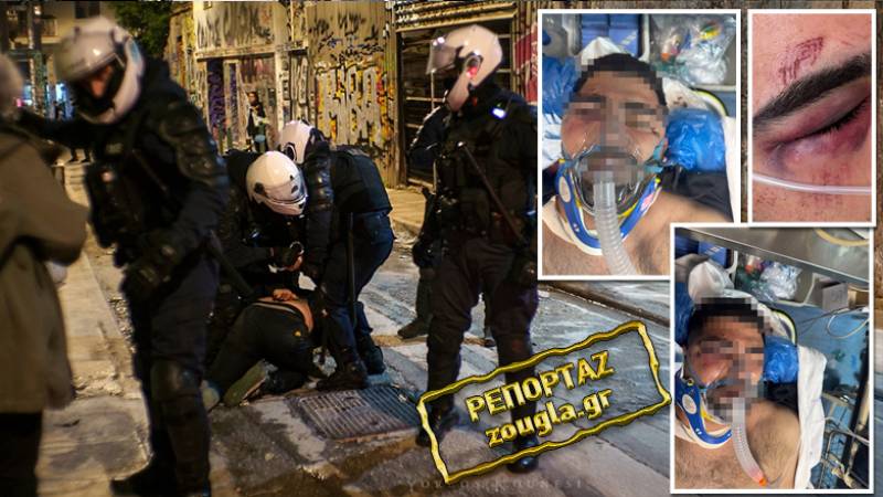 Στην Εντατική ο 20χρονος από επίθεση ανδρών της ΔΙΑΣ